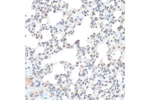Immunohistochemistry of paraffin-embedded Rat lung using Thioredoxin 1 (Trx1/Thioredoxin 1 (Trx1/TXN)) antibody (ABIN7270798) at dilution of 1:100 (40x lens). (TXN antibody  (C-Term))