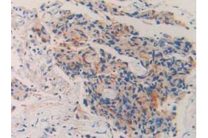 Detection of CD10 in Human Prostate Gland Tissue using Polyclonal Antibody to Neprilysin (CD10) (MME antibody  (AA 382-538))