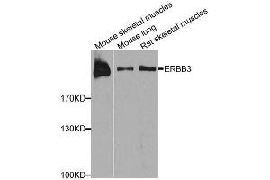 Western blot analysis of extracts of various cell lines, using ERBB3 antibody. (ERBB3 antibody  (AA 20-285))