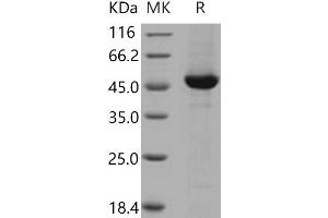 Western Blotting (WB) image for Dopa Decarboxylase (Aromatic L-Amino Acid Decarboxylase) (DDC) (Active) protein (His tag) (ABIN7195446)