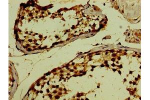 Immunohistochemistry of paraffin-embedded human testis tissue using ABIN7163056 at dilution of 1:100 (PHF6 antibody  (AA 2-312))