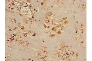 Immunohistochemistry of paraffin-embedded human placenta tissue using ABIN7171778 at dilution of 1:100 (TINF2 antibody  (AA 210-451))