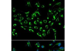 Immunofluorescence analysis of MCF-7 cells using CDKN3 Polyclonal Antibody (CDKN3 antibody)