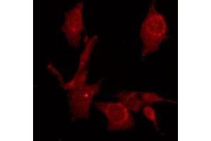 ABIN6275370 staining Hela by IF/ICC. (KCNK1 antibody  (N-Term))