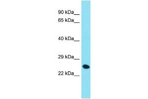 Host: Rabbit  Target Name: Chmp4c  Sample Tissue: Mouse Liver lysates  Antibody Dilution: 1.