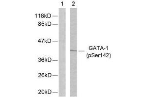 Western blot analysis of extracts from K562 cells using GATA-1 (phospho-Ser142) antibody (E011041). (GATA1 antibody  (pSer142))