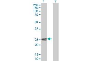 Western Blot analysis of MMACHC expression in transfected 293T cell line by MMACHC MaxPab polyclonal antibody. (MMACHC antibody  (AA 1-225))