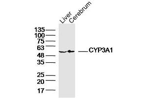 Lane 1: Rat Liver lysates Lane 2: Rat Cerebrum lysates probed with CYP3A1 Polyclonal Antibody, Unconjugated  at 1:300 dilution and 4˚C overnight incubation. (CYP3A1 antibody  (AA 231-330))
