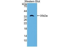 Western blot analysis of the recombinant protein. (Laminin gamma 1 antibody  (AA 1283-1551))