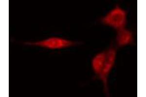 ABIN6274453 staining HeLa cells by IF/ICC. (SMG7 antibody  (Internal Region))