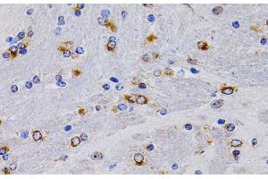 Immunohistochemistry (Paraffin-embedded Sections) (IHC (p)) image for anti-Trefoil Factor 1 (TFF1) antibody (ABIN7259749)