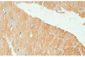 Immunohistochemistry of paraffin-embedded Mouse heart using MYBPC3 Polyclonal Antibody at dilution of 1:100 (40x lens). (MYBPC3 antibody)