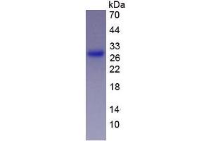 Image no. 2 for Granzyme A (Granzyme 1, Cytotoxic T-Lymphocyte-Associated serine Esterase 3) (GZMA) (AA 29-262) protein (His tag) (ABIN1879813) (GZMA Protein (AA 29-262) (His tag))