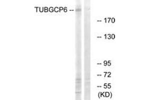Western blot analysis of extracts from COLO cells, using TUBGCP6 Antibody. (GCP6 antibody  (AA 741-790))