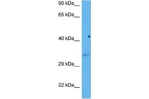 Western Blotting (WB) image for anti-Heme Oxygenase (Decycling) 1 (HMOX1) (N-Term) antibody (ABIN2782158)