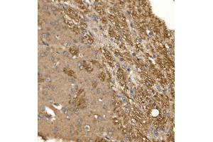 IHC analysis of Paxillin/PXN using anti-Paxillin/PXN antibody (ABIN7602636). (Paxillin antibody  (AA 9-570))