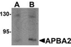 Western blot analysis of APBA2 in human brain tissue lysate with APBA2 antibody at (A) 1 and (B) 2 μg/ml. (APBA2 antibody  (Center))
