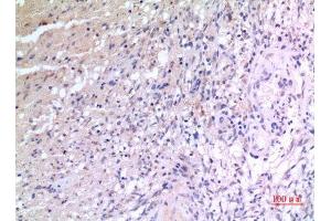 Immunohistochemistry (IHC) image for anti-VGF Nerve Growth Factor Inducible (VGF) (Internal Region) antibody (ABIN6284063)