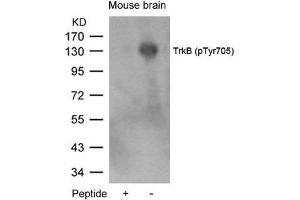 Western blot analysis of extracts from mouse brain tissue using TrkB(Phospho-Tyr705) Antibody and the same antibody preincubated with blocking peptide. (TRKB antibody  (pTyr705))