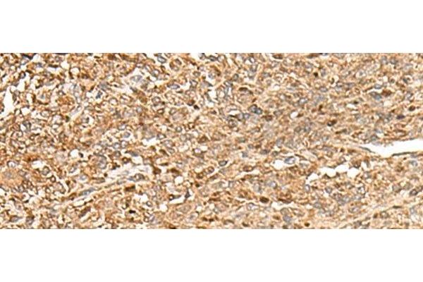 ZC3H7A antibody