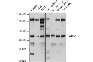 Western blot analysis of extracts of various cell lines, using ODF2 antibody (ABIN7269128) at dilution. (ODF2 antibody  (AA 630-829))