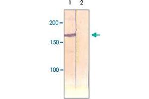 The cell lysate derived from insulin stimulated CHO was immunoprecipitated by IRS1 polyclonal antibody , then immunoprobed by the same antibody at 1 : 500 (Lane 1).