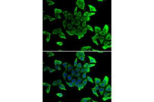 Immunofluorescence analysis of U2OS cells using SGCD antibody (ABIN6292039). (SGCD antibody)