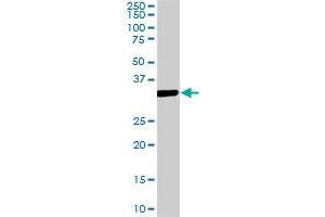MEOX2 monoclonal antibody (M08), clone 5E1. (MEOX2 antibody  (AA 1-303))