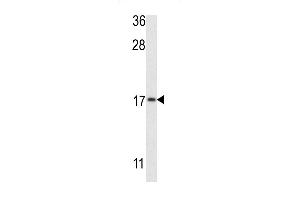 Western blot analysis of G8b (M1LC3B) Antibody (T93/Y99) 1802e in MCF-7 cell line lysates (35 μg/lane). (APG8b (AA 74-106) antibody)