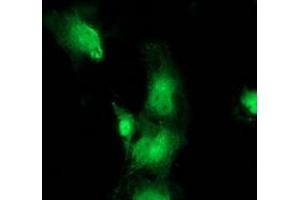 Anti-BEST3 mouse monoclonal antibody (ABIN2453917) immunofluorescent staining of COS7 cells transiently transfected by pCMV6-ENTRY BEST3 (RC218436). (Bestrophin 3 antibody)