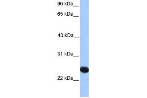 WB Suggested Anti-CSGlcA-T Antibody Titration:  0.