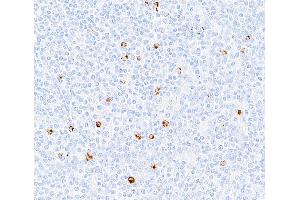 Immunohistochemistry (IHC) image for anti-Lymphocyte-Activation Gene 3 (LAG3) (AA 500-525) antibody (ABIN7454036)