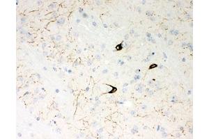 IHC-P: NPY antibody testing of mouse brain tissue (NPY antibody  (Middle Region))