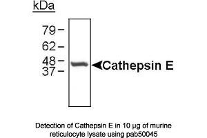 Image no. 1 for anti-Cathepsin E (CTSE) (C-Term) antibody (ABIN363354) (Cathepsin E antibody  (C-Term))