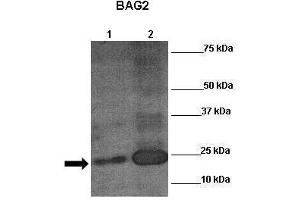 Sample Type: Lane 1:241 µg mouse mesenchymal stem cell lysate Primary Antibody Dilution: 1:0000Secondary Antibody: Anti-rabbit-HRP Secondary Antibody Dilution: 1:00,000 Color/Signal Descriptions: RUNX2  Gene Name: Anonymous Submitted by: (RUNX2 antibody  (N-Term))