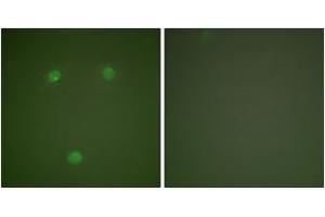 Immunofluorescence analysis of COS7 cells, using GADD153 Antibody. (DDIT3 antibody  (AA 91-140))