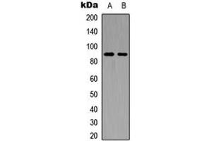 Western blot analysis of FGFR4 expression in HEK293T (A), PC12 (B) whole cell lysates. (FGFR4 antibody  (C-Term))