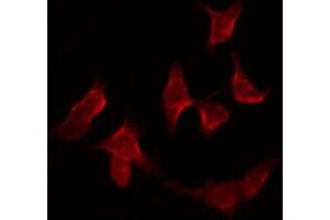 ABIN6266497 staining COLO205 by IF/ICC. (APAF1 antibody  (C-Term))