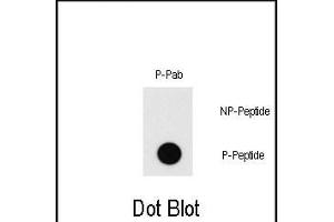 Dot blot analysis of Phospho-MEF2C-T20 Pab (Cat. (MEF2C antibody  (pThr20))