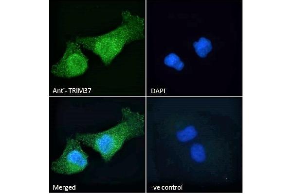 TRIM37 antibody  (C-Term)