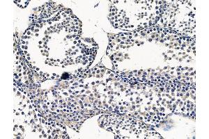 ABIN7096380 and ABIN7100444 at 1/100 staining mouse testis tissue by IHC-P. (PMPCA antibody)