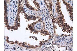 Image no. 10 for anti-Destrin (Actin Depolymerizing Factor) (DSTN) antibody (ABIN1497910) (Destrin antibody)