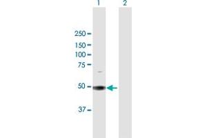 Western Blot analysis of SOCS5 expression in transfected 293T cell line by SOCS5 MaxPab polyclonal antibody. (SOCS5 antibody  (AA 1-536))