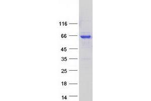 Validation with Western Blot