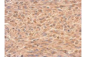 Immunohistochemistry (IHC) image for anti-GDP Dissociation Inhibitor 1 (GDI1) antibody (ABIN2855146)