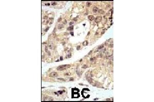 Immunohistochemistry (Paraffin-embedded Sections) (IHC (p)) image for anti-Small Ubiquitin Related Modifier Protein 1 (SUMO1) (AA 1-30), (N-Term) antibody (ABIN1882136)