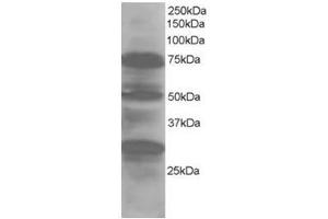 Image no. 1 for anti-LIM Domain 7 (LMO7) (Internal Region) antibody (ABIN374384) (LMO7 antibody  (Internal Region))