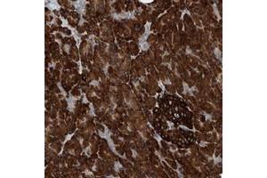 Immunohistochemical staining of human pancreas with YRDC polyclonal antibody  shows strong cytoplasmic positivity in exocrine glandular cells and Islet cells.
