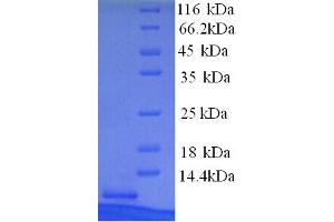 MT1X Protein (AA 1-61) (His tag)