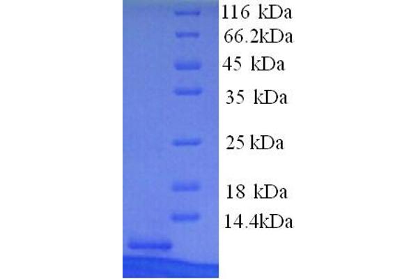 MT1X Protein (AA 1-61) (His tag)